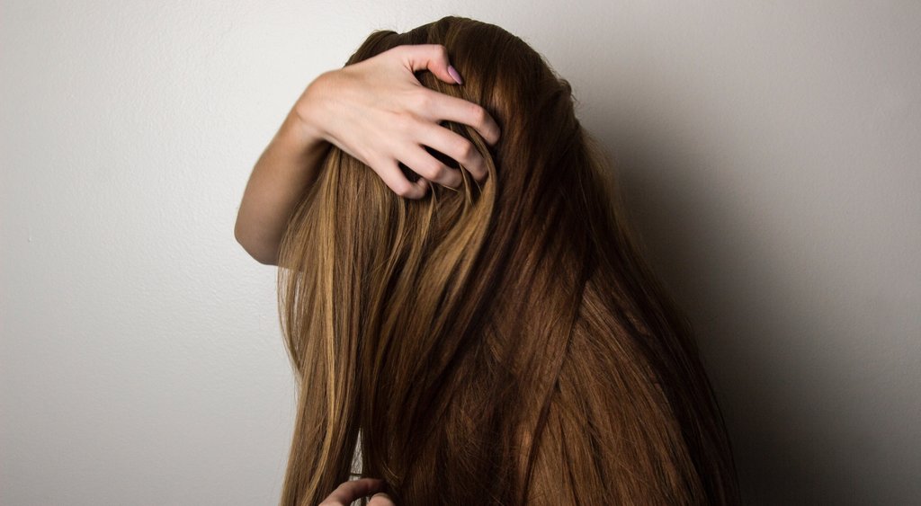 rsz_brown-hair-female-girl-1159334 dandruff